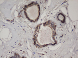 Immunohistochemical staining of paraffin-embedded Human breast tissue within the normal limits using anti-HBS1L mouse monoclonal antibody