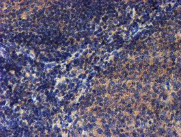 m05938 anti lect2 mouse monoclonal antibody clone id oti2a11 ihc testing 7