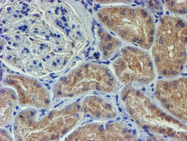 m05938 anti lect2 mouse monoclonal antibody clone id oti2a11 ihc testing 8