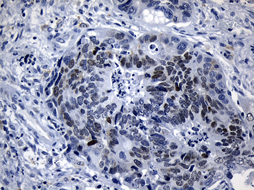 m05940 2 anti lhx2 mouse monoclonal antibody clone id oti5c7 ihc testing 2