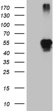m05940 2 anti lhx2 mouse monoclonal antibody clone id oti5c7 wb testing 1