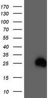 HEK293T cells were transfected with the pCMV6-ENTRY control (Left lane) or pCMV6-ENTRY RHOD (Right lane) cDNA for 48 hrs and lysed