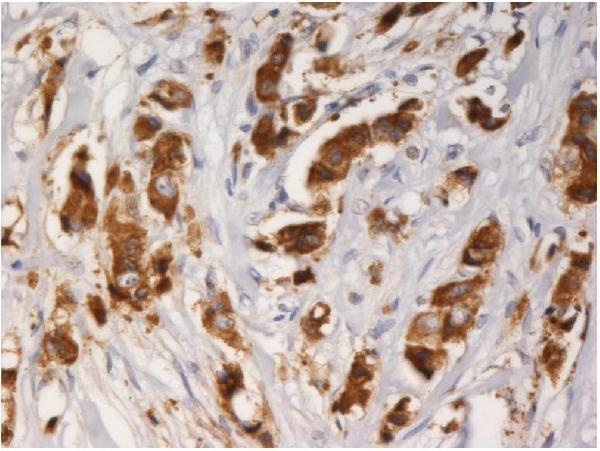 Immunohistochemistry staining of AGR3 with mouse monoclonal AGR3