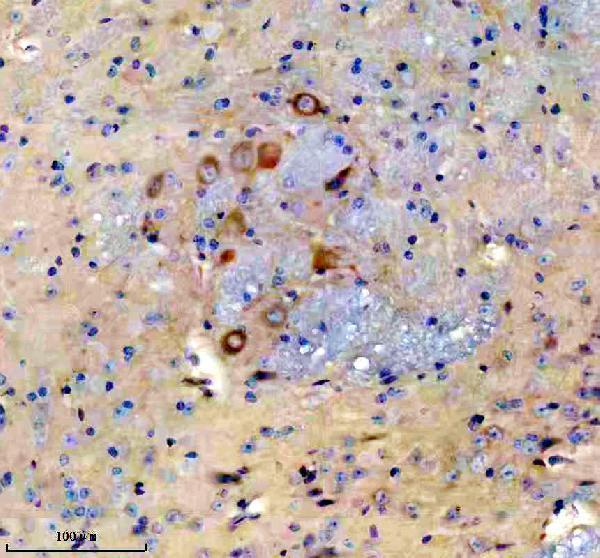 m05962 1 ncr2 primary antibodies ihc testing 1