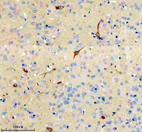 m05962 1 ncr2 primary antibodies ihc testing 2