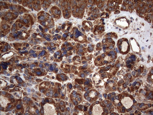 m05962 anti ncr2 mouse monoclonal antibody clone id oti4b8 ihc testing 2