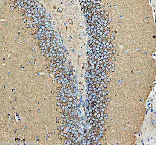 m05980 1 hapln1 primary antibodies ihc testing 1