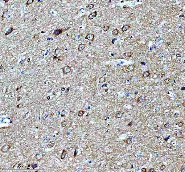 m05980 1 hapln1 primary antibodies ihc testing 3