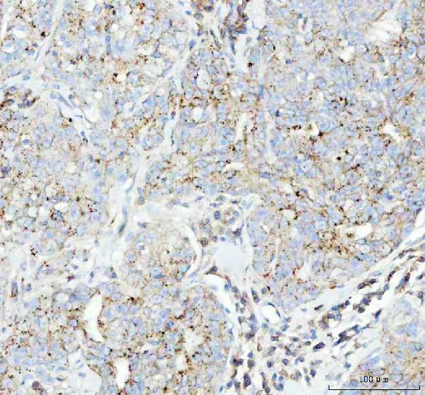  IHC analysis of Flotillin 1 using anti-Flotillin 1 antibody (M05980)