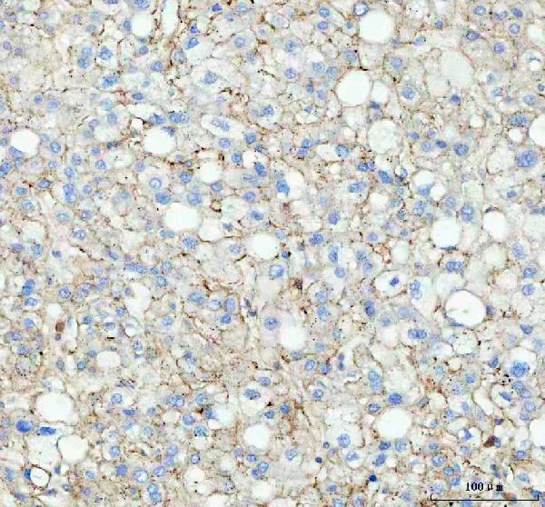  IHC analysis of Flotillin 1 using anti-Flotillin 1 antibody (M05980)