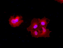 m05985 anti carboxypeptidase a cpa1 mouse monoclonal antibody clone id oti2a3 if testing 12