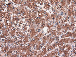 m05985 anti carboxypeptidase a cpa1 mouse monoclonal antibody clone id oti2a3 ihc testing 11