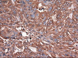 m05985 anti carboxypeptidase a cpa1 mouse monoclonal antibody clone id oti2a3 ihc testing 2