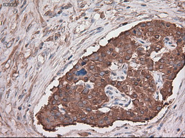 m05985 anti carboxypeptidase a cpa1 mouse monoclonal antibody clone id oti2a3 ihc testing 3