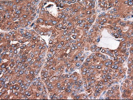 m05985 anti carboxypeptidase a cpa1 mouse monoclonal antibody clone id oti2a3 ihc testing 4