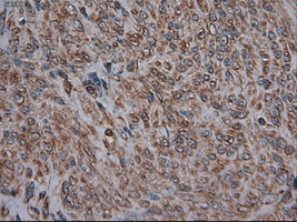 m05985 anti carboxypeptidase a cpa1 mouse monoclonal antibody clone id oti2a3 ihc testing 5