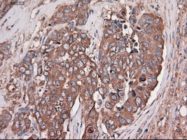 m05985 anti carboxypeptidase a cpa1 mouse monoclonal antibody clone id oti2a3 ihc testing 7