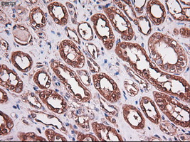 m05985 anti carboxypeptidase a cpa1 mouse monoclonal antibody clone id oti2a3 ihc testing 8