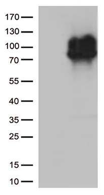 HEK293T cells were transfected with the pCMV6-ENTRY control (Left lane) or pCMV6-ENTRY IFNLR1 (Right lane) cDNA for 48 hrs and lysed