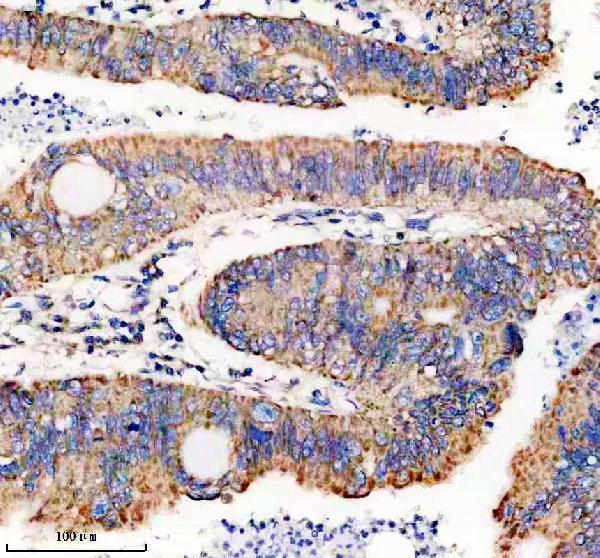 m05998 1 got2 primary antibodies ihc testing 1