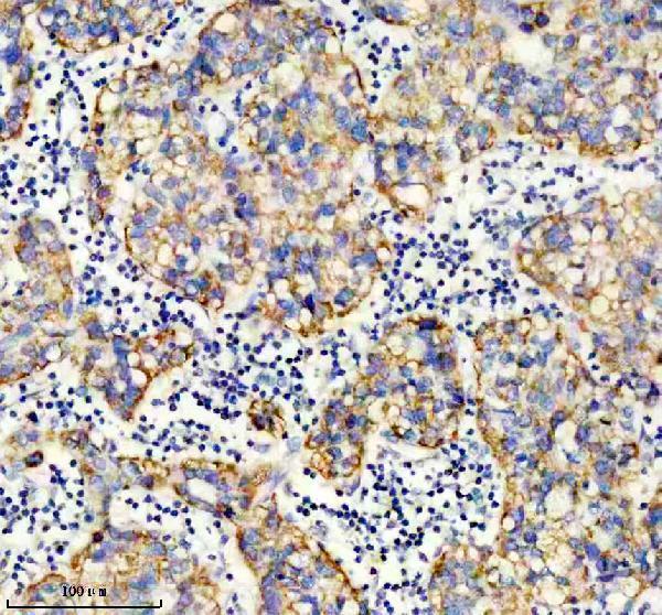 m05998 1 got2 primary antibodies ihc testing 2