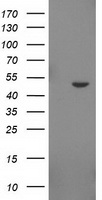 HEK293T cells were transfected with the pCMV6-ENTRY control (Left lane) or pCMV6-ENTRY IDO2 (Right lane) cDNA for 48 hrs and lysed