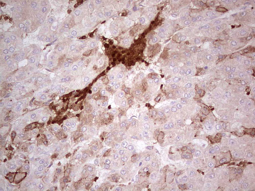m06002 3 anti indol1 ido2 mouse monoclonal antibody clone id oti11b2 ihc testing 3