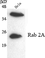 Western Blot analysis using Rab 2A Monoclonal Antibody against HeLa cell lysate