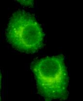 Immunocytochemistry of HeLa cells using anti- RAB2A(C-Terminus) antibody diluted 1:200