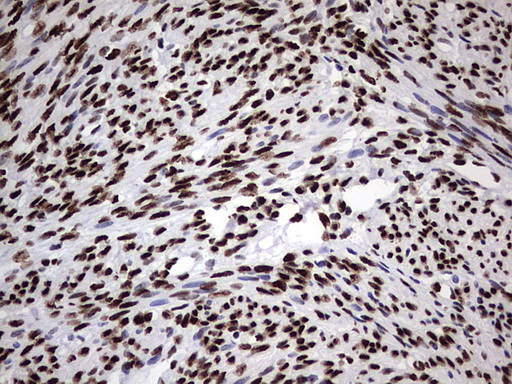 m06017 anti hnrpm hnrnpm mouse monoclonal antibody clone id oti4c9 ihc testing 10