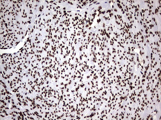 m06017 anti hnrpm hnrnpm mouse monoclonal antibody clone id oti4c9 ihc testing 11