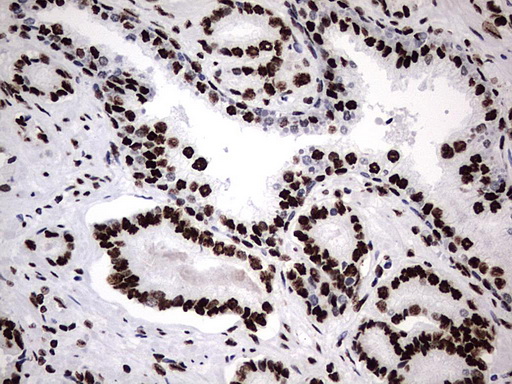 m06017 anti hnrpm hnrnpm mouse monoclonal antibody clone id oti4c9 ihc testing 12