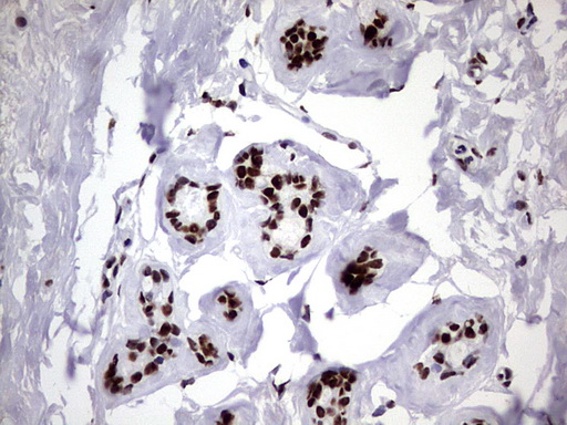 m06017 anti hnrpm hnrnpm mouse monoclonal antibody clone id oti4c9 ihc testing 13