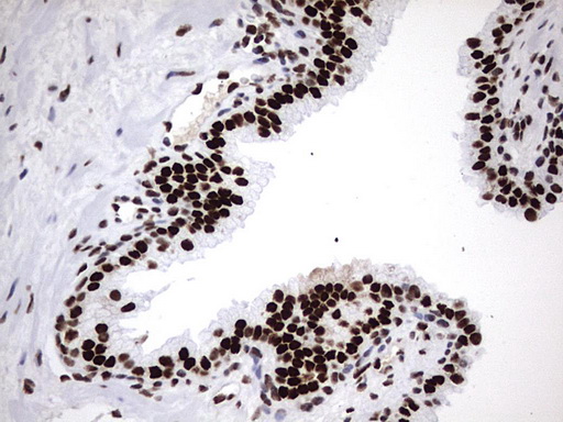 m06017 anti hnrpm hnrnpm mouse monoclonal antibody clone id oti4c9 ihc testing 14