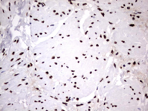 m06017 anti hnrpm hnrnpm mouse monoclonal antibody clone id oti4c9 ihc testing 15