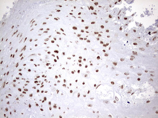 m06017 anti hnrpm hnrnpm mouse monoclonal antibody clone id oti4c9 ihc testing 16