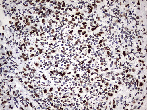 m06017 anti hnrpm hnrnpm mouse monoclonal antibody clone id oti4c9 ihc testing 17
