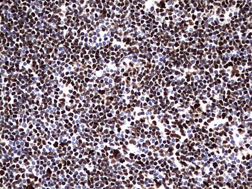 m06017 anti hnrpm hnrnpm mouse monoclonal antibody clone id oti4c9 ihc testing 18