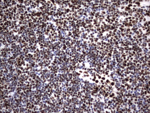m06017 anti hnrpm hnrnpm mouse monoclonal antibody clone id oti4c9 ihc testing 19