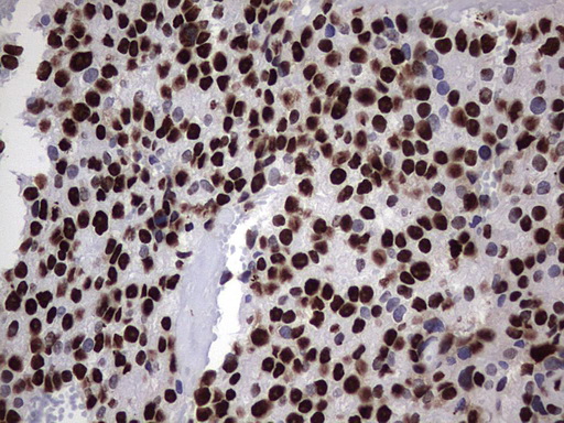 m06017 anti hnrpm hnrnpm mouse monoclonal antibody clone id oti4c9 ihc testing 20
