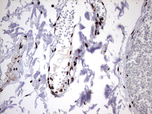 m06017 anti hnrpm hnrnpm mouse monoclonal antibody clone id oti4c9 ihc testing 21