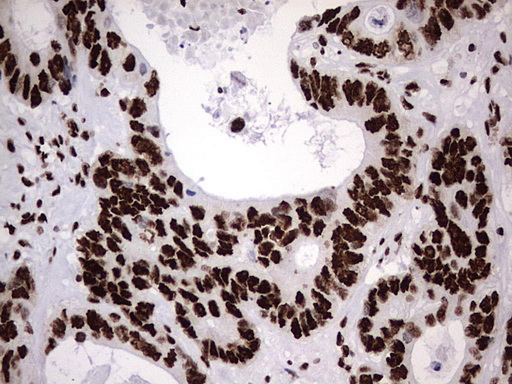 m06017 anti hnrpm hnrnpm mouse monoclonal antibody clone id oti4c9 ihc testing 22