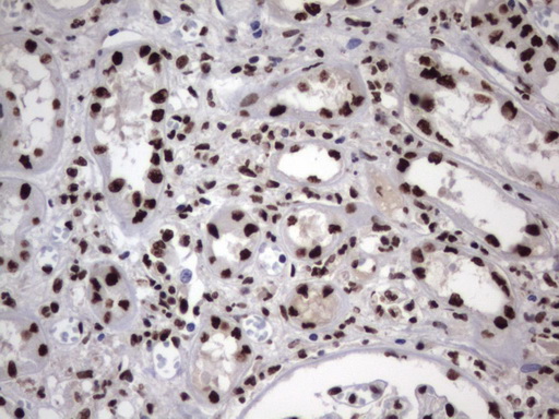 m06017 anti hnrpm hnrnpm mouse monoclonal antibody clone id oti4c9 ihc testing 23