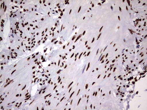 m06017 anti hnrpm hnrnpm mouse monoclonal antibody clone id oti4c9 ihc testing 24