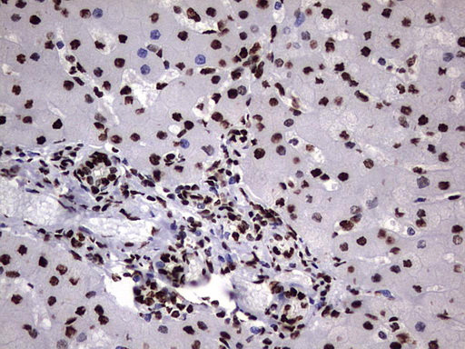 m06017 anti hnrpm hnrnpm mouse monoclonal antibody clone id oti4c9 ihc testing 25
