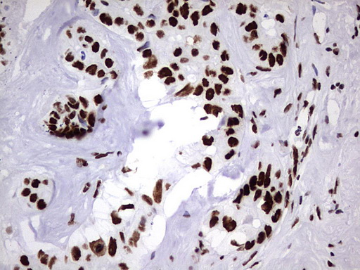 m06017 anti hnrpm hnrnpm mouse monoclonal antibody clone id oti4c9 ihc testing 26