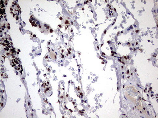 m06017 anti hnrpm hnrnpm mouse monoclonal antibody clone id oti4c9 ihc testing 27