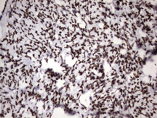 m06017 anti hnrpm hnrnpm mouse monoclonal antibody clone id oti4c9 ihc testing 4