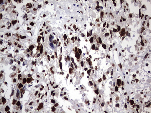 m06017 anti hnrpm hnrnpm mouse monoclonal antibody clone id oti4c9 ihc testing 5