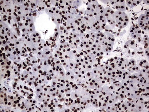 m06017 anti hnrpm hnrnpm mouse monoclonal antibody clone id oti4c9 ihc testing 6